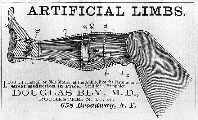 ARTIFICIAL LIMB DOCTOR DOUGLAS BLY ANTIQUE ADVERTISMENT  